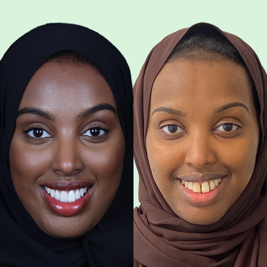 Før og etter lukking av tannluke hos Smile Nordic